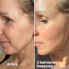 Retinal Celimax Shot - Tratamiento Antiedad Intensivo