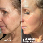 Retinal Celimax Shot - Tratamiento Antiedad Intensivo