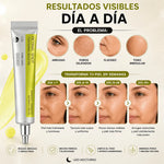 Retinal Celimax Shot - Tratamiento Antiedad Intensivo